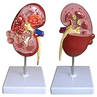 Teaching Model,Kidney Education Model Working Kidney Model with 2 Detachable Parts & 24 Digital Labeled & Anatomical Position Instructions for Demonstrate The Structure and Functio