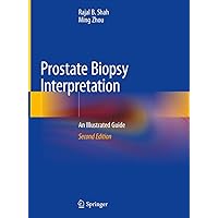 Prostate Biopsy Interpretation: An Illustrated Guide Prostate Biopsy Interpretation: An Illustrated Guide Hardcover Kindle Paperback