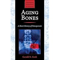 Aging Bones: A Short History of Osteoporosis (Johns Hopkins Biographies of Disease) Aging Bones: A Short History of Osteoporosis (Johns Hopkins Biographies of Disease) Paperback Kindle