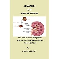 Advances on Kidney Stones: Prevalence, Diagnosis, Prevention and Treatment of Renal Calculi Advances on Kidney Stones: Prevalence, Diagnosis, Prevention and Treatment of Renal Calculi Kindle Paperback