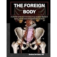 The Foreign Body: A collection of the most interesting X-rays of things that don't belong and the stories behind how they got there! The Foreign Body: A collection of the most interesting X-rays of things that don't belong and the stories behind how they got there! Paperback Kindle