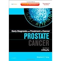Early Diagnosis and Treatment of Cancer Series: Prostate Cancer: Expert Consult - Online and Print (Early Diagnosis in Cancer) Early Diagnosis and Treatment of Cancer Series: Prostate Cancer: Expert Consult - Online and Print (Early Diagnosis in Cancer) Hardcover