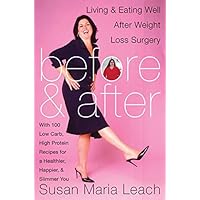 Before and After: Living and Eating Well After Weight Loss Surgery Before and After: Living and Eating Well After Weight Loss Surgery Hardcover Paperback