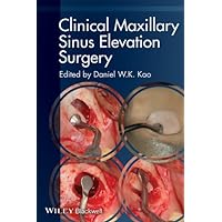 Clinical Maxillary Sinus Elevation Surgery Clinical Maxillary Sinus Elevation Surgery Kindle Paperback