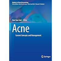 Acne: Current Concepts and Management (Updates in Clinical Dermatology) Acne: Current Concepts and Management (Updates in Clinical Dermatology) Paperback Kindle Hardcover