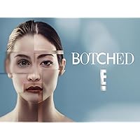 Botched, Season 4