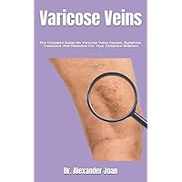 Varicose Veins: The Complete Guide On Varicose Veins Causes, Symptom, Treatment And Remedies For Your Complete Wellness Varicose Veins: The Complete Guide On Varicose Veins Causes, Symptom, Treatment And Remedies For Your Complete Wellness Paperback Kindle