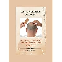 HOW TO CONTROL BALDNESS: THE ULTIMATE REMEDIES TO CURE BALDNESS AND HAIR LOSS. HOW TO CONTROL BALDNESS: THE ULTIMATE REMEDIES TO CURE BALDNESS AND HAIR LOSS. Paperback Kindle