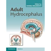 Adult Hydrocephalus Adult Hydrocephalus Kindle Hardcover