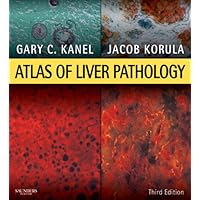 Atlas of Liver Pathology E-Book: Expert Consult - Online and Print (Atlas of Surgical Pathology) Atlas of Liver Pathology E-Book: Expert Consult - Online and Print (Atlas of Surgical Pathology) Kindle Hardcover