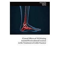Clinical Effects of 3D Printing Assisted Posterolateral Incision in the Treatment of Ankle Fracture