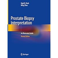 Prostate Biopsy Interpretation: An Illustrated Guide Prostate Biopsy Interpretation: An Illustrated Guide Kindle Hardcover Paperback