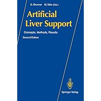 Artificial Liver Support: Concepts, Methods, Results Artificial Liver Support: Concepts, Methods, Results Paperback