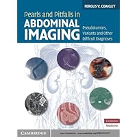 Pearls and Pitfalls in Abdominal Imaging: Pseudotumors, Variants and Other Difficult Diagnoses (Cambridge Medicine (Hardcover)) Pearls and Pitfalls in Abdominal Imaging: Pseudotumors, Variants and Other Difficult Diagnoses (Cambridge Medicine (Hardcover)) eTextbook Hardcover