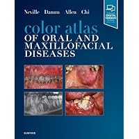 Color Atlas of Oral and Maxillofacial Diseases Color Atlas of Oral and Maxillofacial Diseases Hardcover Kindle