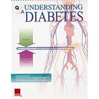 Understanding Diabetes Flip Chart Understanding Diabetes Flip Chart Spiral-bound