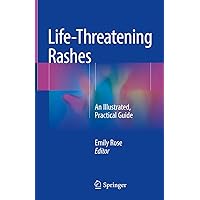Life-Threatening Rashes: An Illustrated, Practical Guide Life-Threatening Rashes: An Illustrated, Practical Guide Hardcover Kindle Paperback