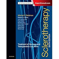 Sclerotherapy: Treatment of Varicose and Telangiectatic Leg Veins Sclerotherapy: Treatment of Varicose and Telangiectatic Leg Veins Hardcover eTextbook