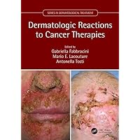 Dermatologic Reactions to Cancer Therapies (Series in Dermatological Treatment) Dermatologic Reactions to Cancer Therapies (Series in Dermatological Treatment) Paperback Kindle Hardcover