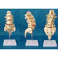Medical Human Spine Spine Pathology Demonstration Model Anatomical Model Lumbar Vertebrae Sacrum & Coccyx, with Herniation Disc Sold by East dental
