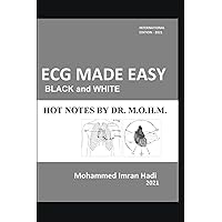 ECG MADE EASY : BLACK and WHITE: HOT NOTES BY DR. M.O.H.M. (Focused History taking and Clinical Examination)