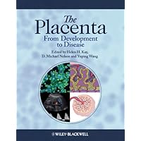 The Placenta: From Development to Disease The Placenta: From Development to Disease Kindle Hardcover