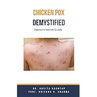 Chickenpox Demystified: Doctor's Secret Guide