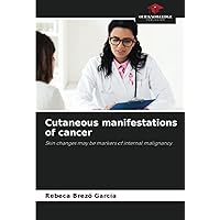 Cutaneous manifestations of cancer: Skin changes may be markers of internal malignancy