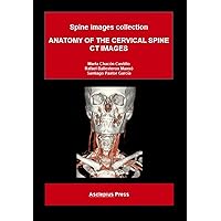 ANATOMY OF THE CERVICAL SPINE. CT IMAGES: Spine images collection ANATOMY OF THE CERVICAL SPINE. CT IMAGES: Spine images collection Kindle Paperback