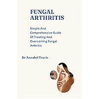 FUNGAL ARTHRITIS: Simple And Comprehensive Guide Of Treating And Overcoming Fungal Arthritis FUNGAL ARTHRITIS: Simple And Comprehensive Guide Of Treating And Overcoming Fungal Arthritis Kindle Paperback