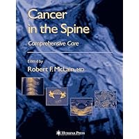 Cancer in the Spine: Comprehensive Care (Current Clinical Oncology) Cancer in the Spine: Comprehensive Care (Current Clinical Oncology) Kindle Hardcover Paperback