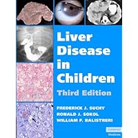 Liver Disease in Children Liver Disease in Children Kindle Hardcover
