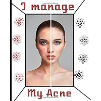 I manage my acne: Moderate your acne on a daily basis, with follow-ups on symptoms, diet, treatments, pain intensity, etc... 8X10, 101 pages