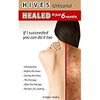 HIVES(Urticaria)HEALED In just 6 months: If i succeeded you do it too HIVES(Urticaria)HEALED In just 6 months: If i succeeded you do it too Paperback