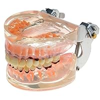 Dental Study Transparent Adult Pathological Periodontal Disease Teeth Model 4017