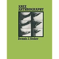 Knee Arthrography Knee Arthrography Paperback