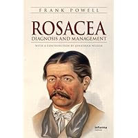 Rosacea: Diagnosis and Management Rosacea: Diagnosis and Management Hardcover