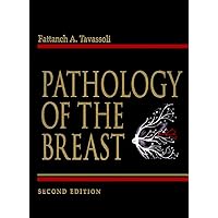 Pathology of The Breast Pathology of The Breast Hardcover