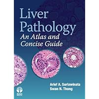 Liver Pathology: An Atlas and Concise Guide Liver Pathology: An Atlas and Concise Guide Kindle Hardcover