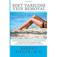 Soft varicose vein removal [Paperback] [2012] (Author) Berndt Rieger M.D.