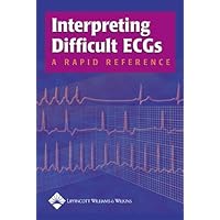 Interpreting Difficult ECGs: A Rapid Reference Interpreting Difficult ECGs: A Rapid Reference Paperback