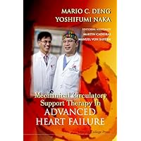 MECHANICAL CIRCULATORY SUPPORT THERAPY IN ADVANCED HEART FAILURE MECHANICAL CIRCULATORY SUPPORT THERAPY IN ADVANCED HEART FAILURE Hardcover Paperback