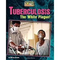Tuberculosis: The White Plague! (Nightmare Plagues) Tuberculosis: The White Plague! (Nightmare Plagues) Library Binding