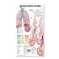 Understanding Asthma Anatomical Chart