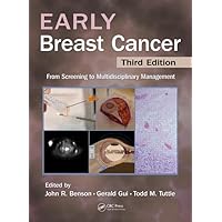 Early Breast Cancer: From Screening to Multidisciplinary Management, Third Edition Early Breast Cancer: From Screening to Multidisciplinary Management, Third Edition Hardcover Paperback