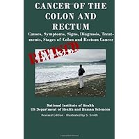 Cancer Of The Colon And Rectum: Causes, Symptoms, Signs, Diagnosis, Treatments, Stages of Colon and Rectum Cancer
