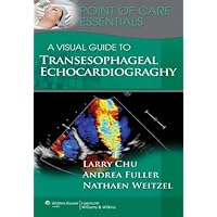A Visual Guide to Transesophageal Echocardiography (Point of Care Essentials) A Visual Guide to Transesophageal Echocardiography (Point of Care Essentials) Kindle Spiral-bound