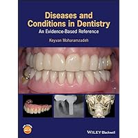 Diseases and Conditions in Dentistry: An Evidence-Based Reference Diseases and Conditions in Dentistry: An Evidence-Based Reference Kindle Hardcover