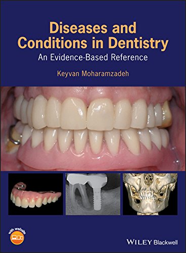 Diseases and Conditions in Dentistry: An Evidence-Based Reference