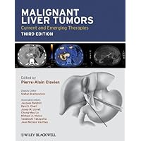 Malignant Liver Tumors: Current and Emerging Therapies Malignant Liver Tumors: Current and Emerging Therapies eTextbook Hardcover